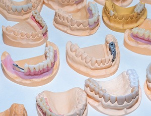 Different types of dentures being made