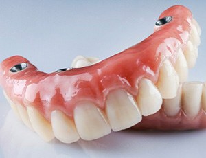 A pair of implant dentures
