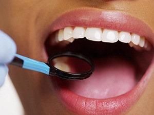 Closeup of patient visiting Fayetteville dentist for checkup